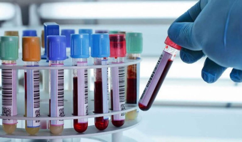 The Blood Sample Blog 18 770x454